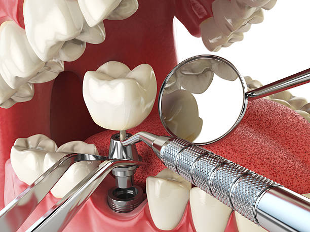 Best Pediatric Emergency Dentist in Gardiner, ME